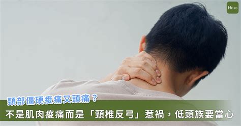 反弓|頸椎反弓：症狀、病因及如何治療